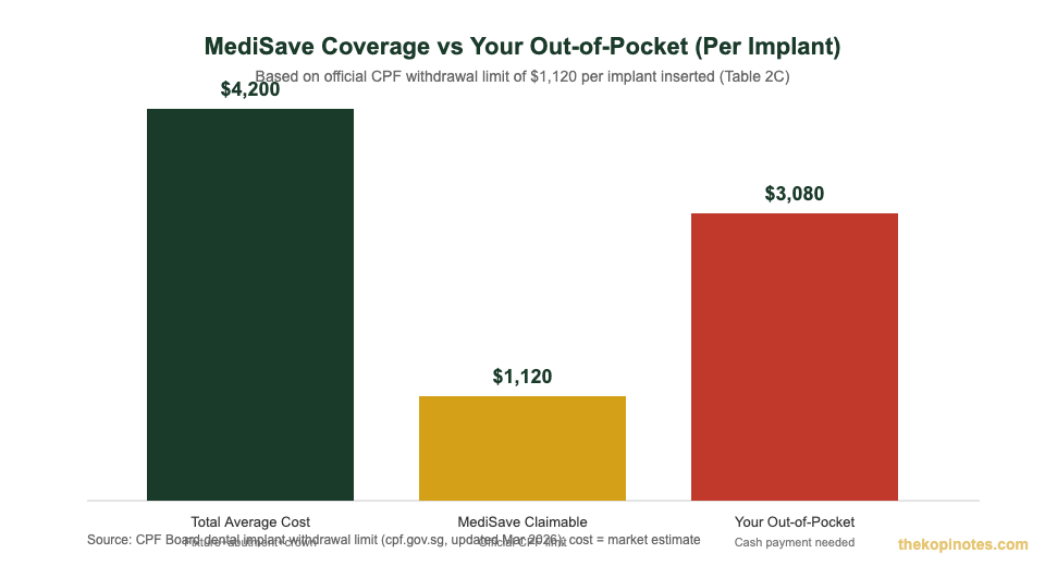 MediSave coverage vs out-of-pocket cost per dental implant Singapore 2026