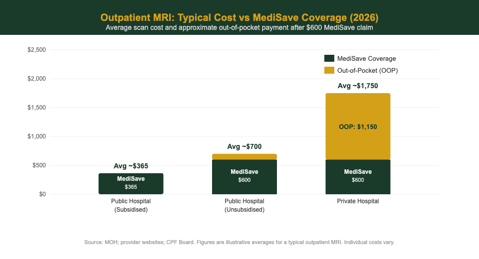 Outpatient MRI cost vs MediSave coverage comparison chart: public subsidised vs private hospital Singapore 2026